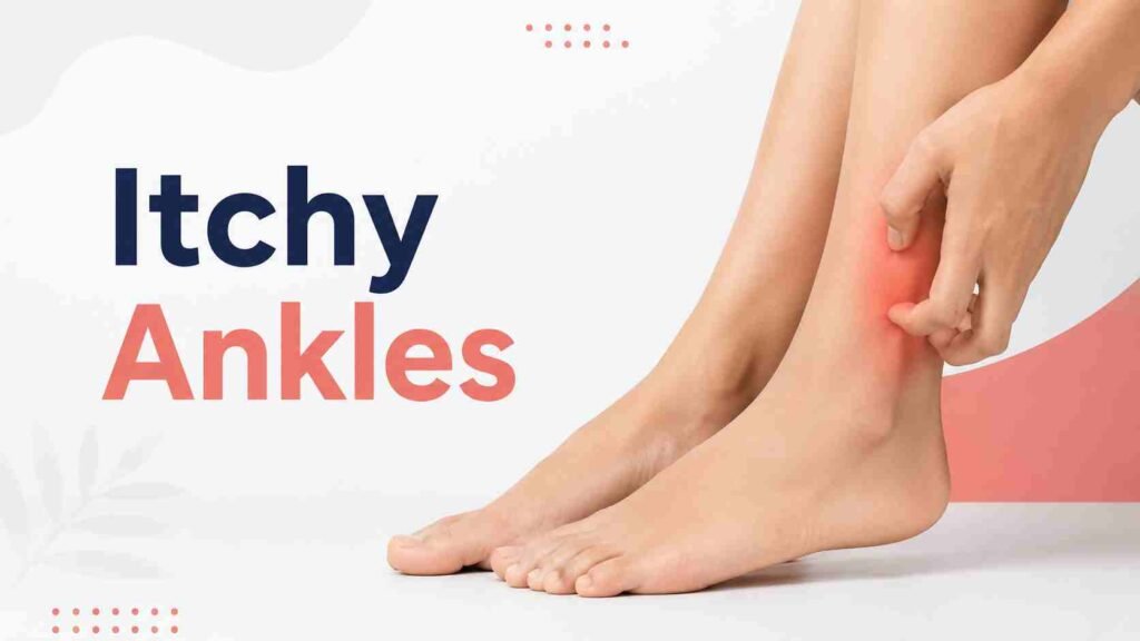 Itchy Ankles